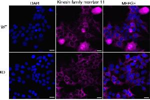 anti-Kinesin Family Member 11 (KIF11) antibody