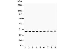 Western blot testing of PRDX3 antibody and Lane 1:  rat brain (Peroxiredoxin 3 antibody  (AA 110-256))