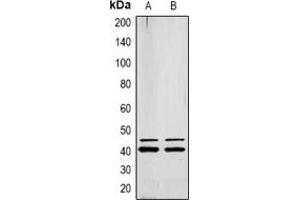 Western blot analysis of ERK1/2 (pY222/205) expression in MCF7 (A), Jurkat (B) whole cell lysates. (ERK1/2 antibody  (pTyr205, pTyr222))