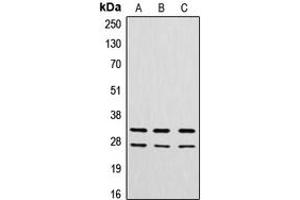Western blot analysis of Cathepsin G expression in A549 (A), MCF7 (B), rat heart (C) whole cell lysates. (Cathepsin G antibody  (N-Term))