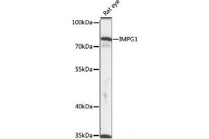 Western blot analysis of extracts of Rat eye using IMPG1 Polyclonal Antibody at dilution of 1:1000. (IMPG1 antibody)