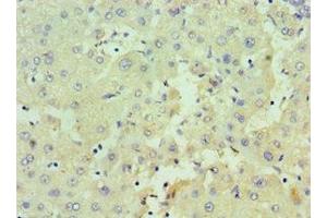 Immunohistochemistry of paraffin-embedded human liver tissue using ABIN7162980 at dilution of 1:100 (HSD17B4 antibody  (AA 437-736))