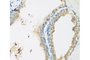 Immunohistochemistry of paraffin-embedded Human prostate using WDR77 Polyclonal Antibody at dilution of 1:200 (40x lens). (WDR77 antibody)