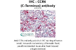 Image no. 1 for anti-Chemokine (C-C Motif) Receptor 6 (CCR6) (C-Term) antibody (ABIN1732778) (CCR6 antibody  (C-Term))