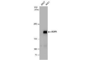 WB Image EGFR antibody detects EGFR protein by western blot analysis. (EGFR antibody  (N-Term))