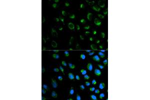 Immunofluorescence analysis of MCF7 cell using FXN antibody. (Frataxin antibody)