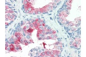 Human Prostate (formalin-fixed, paraffin-embedded) stained with ANXA1at 20 µg/ml followed by biotinylated goat anti-rabbit IgG secondary antibody, alkaline phosphatase-streptavidin and chromogen. (Annexin a1 antibody  (N-Term))