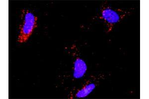 Proximity Ligation Analysis of protein-protein interactions between E2F2 and E2F1. (E2F2 antibody  (AA 1-437))