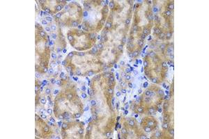Immunohistochemistry of paraffin-embedded mouse kidney using SPARC antibody (ABIN3022250, ABIN3022251, ABIN1513555 and ABIN6218694) at dilution of 1:100 (40x lens). (SPARC antibody  (AA 18-303))