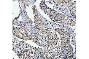 IHC analysis of hnRNP L/HNRNPL using anti-hnRNP L/HNRNPL antibody (ABIN7600130). (HNRNPL antibody  (AA 152-569))