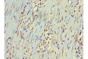 Immunohistochemistry of paraffin-embedded human epityphlon tissue using ABIN7165931 at dilution of 1:100 (DARPP32 antibody  (Regulatory Subunit 1B))