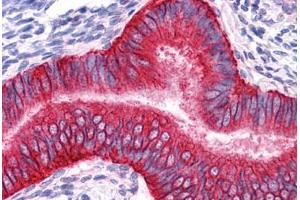Human Uterus: Formalin-Fixed, Paraffin-Embedded (FFPE) (EpCAM antibody)