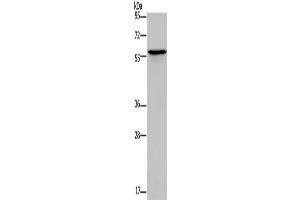 Gel: 10 % SDS-PAGE, Lysate: 40 μg, Lane: Human lung cancer tissue, Primary antibody: ABIN7189699(ADRA1B Antibody) at dilution 1/550, Secondary antibody: Goat anti rabbit IgG at 1/8000 dilution, Exposure time: 1 minute