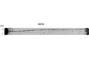SOCS1 antibody - N-terminal region  validated by WB using Huh7 Cells transfected with microRNA at 1:1000.