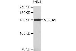 Western blot analysis of extracts of HeLa cells, using MGEA5 antibody. (MGEA5 antibody)