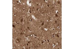Immunohistochemical staining (Formalin-fixed paraffin-embedded sections) of human cerebral cortex with MT3 polyclonal antibody  shows strong nuclear and cytoplasmic positivity in neuronal cells and glial cells. (MT3 antibody)