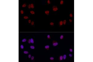 Immunofluorescence analysis of A-549 cells using YE Rabbit pAb (ABIN6130808, ABIN6150331, ABIN6150332 and ABIN6221925) at dilution of 1:50 (40x lens). (GAS41 antibody  (AA 1-227))
