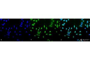 Immunocytochemistry/Immunofluorescence analysis using Rabbit Anti-Acetylated Lysine Polyclonal Antibody . (Lysine (lys) (acetylated) antibody (PE))
