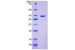 SDS-PAGE (SDS) image for Ficolin (Collagen/fibrinogen Domain Containing) 1 (FCN1) (AA 25-279) protein (His tag) (ABIN2124840)