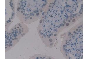 Immunohistochemistry (IHC) image for anti-Transcription Elongation Factor B (SIII), Polypeptide 3 (110kDa, Elongin A) (TCEB3) (AA 76-345) antibody (ABIN7442822)