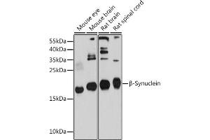 Western blot analysis of extracts of various cell lines, using β-Synuclein antibody (ABIN6127517, ABIN6148193, ABIN6148194 and ABIN6214698) at 1:1000 dilution. (beta Synuclein antibody  (AA 1-134))