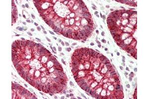 Human Colon: Formalin-Fixed, Paraffin-Embedded (FFPE). (SLC39A5 antibody  (N-Term))