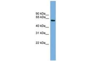 Image no. 1 for anti-Kruppel-Like Factor 11 (KLF11) (AA 151-200) antibody (ABIN6744644) (KLF11 antibody  (AA 151-200))