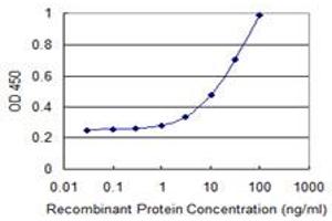 Detection limit for recombinant GST tagged PIGT is 1 ng/ml as a capture antibody. (PIGT antibody  (AA 24-123))