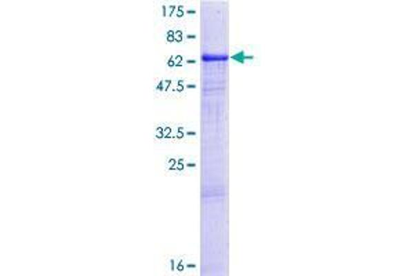 CA14 Protein (AA 1-337) (GST tag)