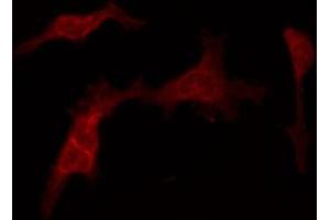 ABIN6266684 staining NIH-3T3 by IF/ICC. (TAF4 antibody)