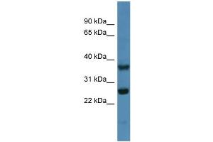 WB Suggested Anti-Atp5f1 Antibody Titration: 0. (ATP5F1 antibody  (N-Term))