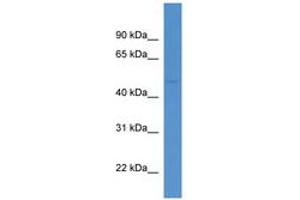 Image no. 1 for anti-Neutral Cholesterol Ester Hydrolase 1 (NCEH1) (AA 224-273) antibody (ABIN6746306)