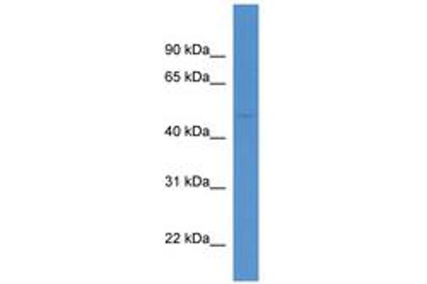 NCEH1 antibody  (AA 224-273)