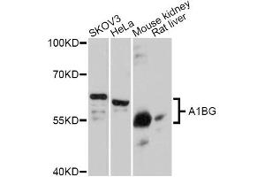 Western blot analysis of extracts of various cell lines, using A1BG Antibody (ABIN5997159) at 1:3000 dilution. (A1BG antibody)