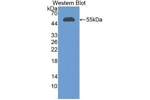 Western blot analysis of recombinant Human CFI. (Complement Factor I antibody  (AA 28-243))