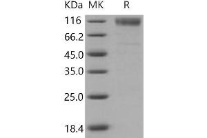Western Blotting (WB) image for Scavenger Receptor Class B, Member 1 (SCARB1) protein (His tag,Fc Tag) (ABIN7320320) (SCARB1 Protein (His tag,Fc Tag))