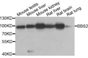 Western blot analysis of extracts of various cell lines, using BBS2 antibody.