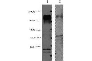 Western Blot analysis of 1) Hela, 2) Mouse brain using ERBB2 Monoclonal Antibody at dilution of 1:4000. (ErbB2/Her2 antibody)