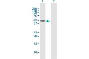 Western Blotting (WB) image for anti-BCL2-Associated Athanogene 5 (BAG5) (AA 1-447) antibody (ABIN950057)