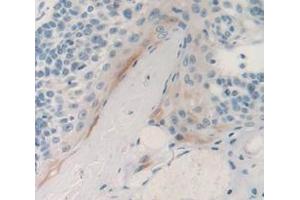 IHC-P analysis of Human Tissue, with DAB staining. (PSCA antibody  (AA 22-123))