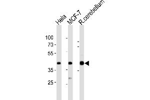 Western blot analysis of lysates from Hela, MCF-7 cell line, rat cerebellum tissue lysate(from left to right), using LTM4B Antibody (4) 20871a.