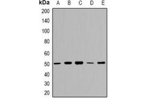 Western blot analysis of GDI2 expression in A549 (A), HT29 (B), K562 (C), mouse kidney (D), mouse lung (E) whole cell lysates. (GDI2 antibody  (C-Term))