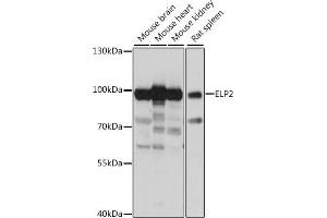 Western blot analysis of extracts of various cell lines, using ELP2 antibody (ABIN7266926) at 1:1000 dilution. (ELP2 antibody  (AA 300-600))