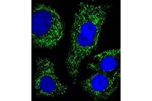 Fluorescent image of SK-BR-3 cells stained with ATP5B Antibody (Center) (ABIN650786 and ABIN2839558). (ATP5B antibody  (AA 135-163))