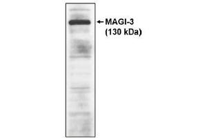 Image no. 1 for anti-Membrane Associated Guanylate Kinase, WW and PDZ Domain Containing 3 (MAGI3) antibody (ABIN264919) (MAGI3 antibody)