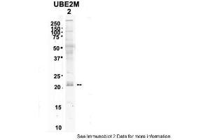 Sample Type:2. (UBE2M antibody  (N-Term))