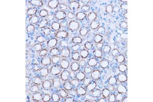 Immunohistochemistry (IHC) image for anti-Mitochondrially Encoded NADH Dehydrogenase 3 (MT-ND3) antibody (ABIN7268601)