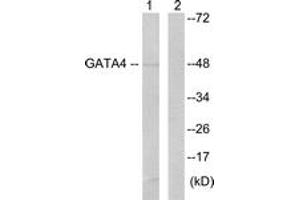 Western Blotting (WB) image for anti-GATA Binding Protein 4 (GATA4) (AA 71-120) antibody (ABIN2888840) (GATA4 antibody  (AA 71-120))