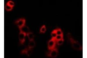 Immunofluorescent analysis of MKK5 staining in U2OS cells. (MAP2K5 antibody)