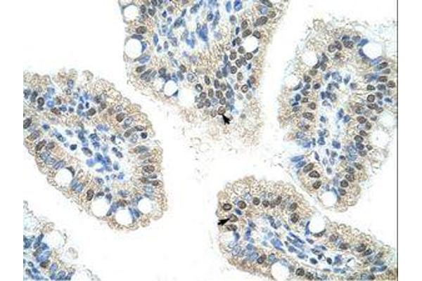 Nucleolar Protein 6 antibody  (C-Term)